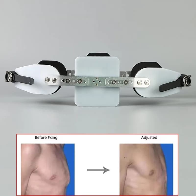 Einstellbare Pectus Carinatum Orthese Klammer Taube Brust Orthese Unterstützung Rippen Valgus Orthese Hosenträger Kinder Erwachsene Universal